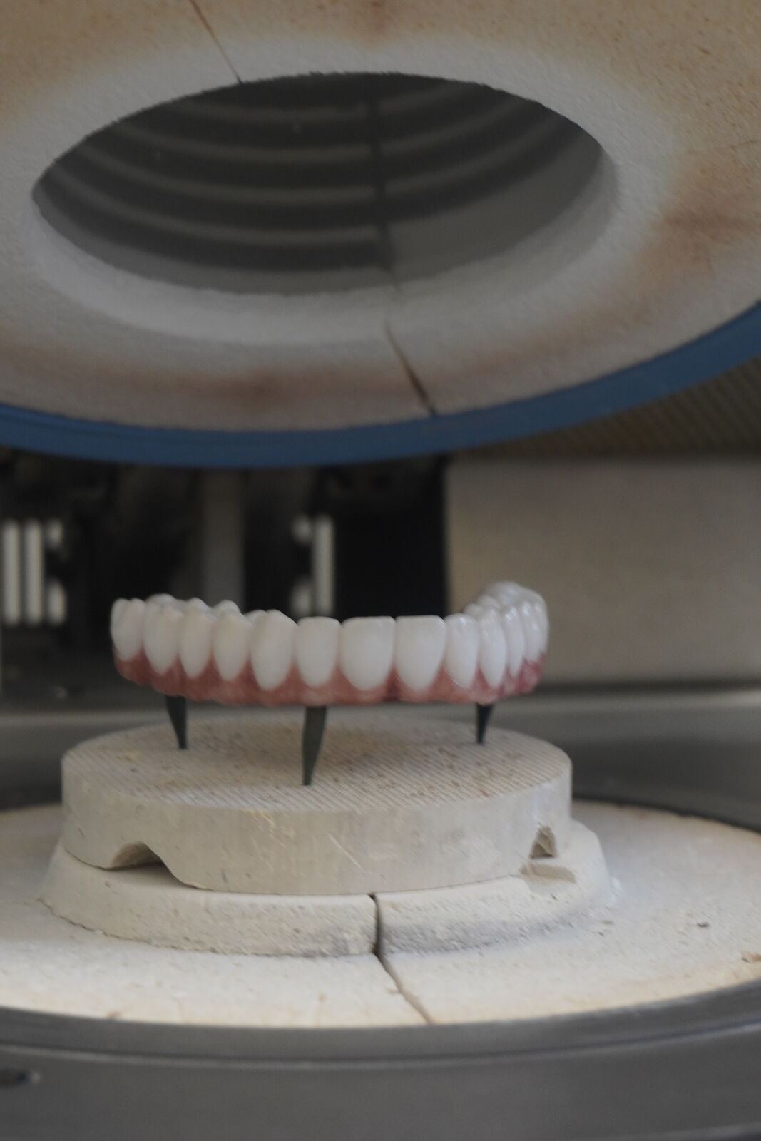 Prosthetic tooth arch inside a dental ceramic firing oven
