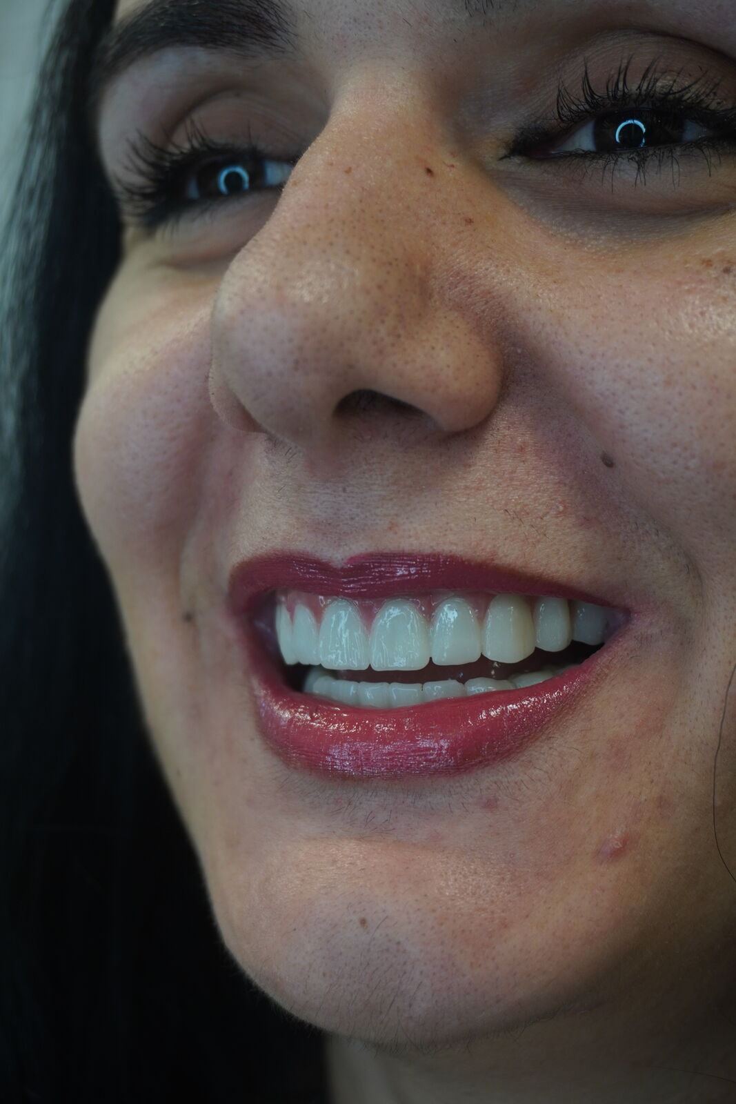Close-up portrait of a smiling patient