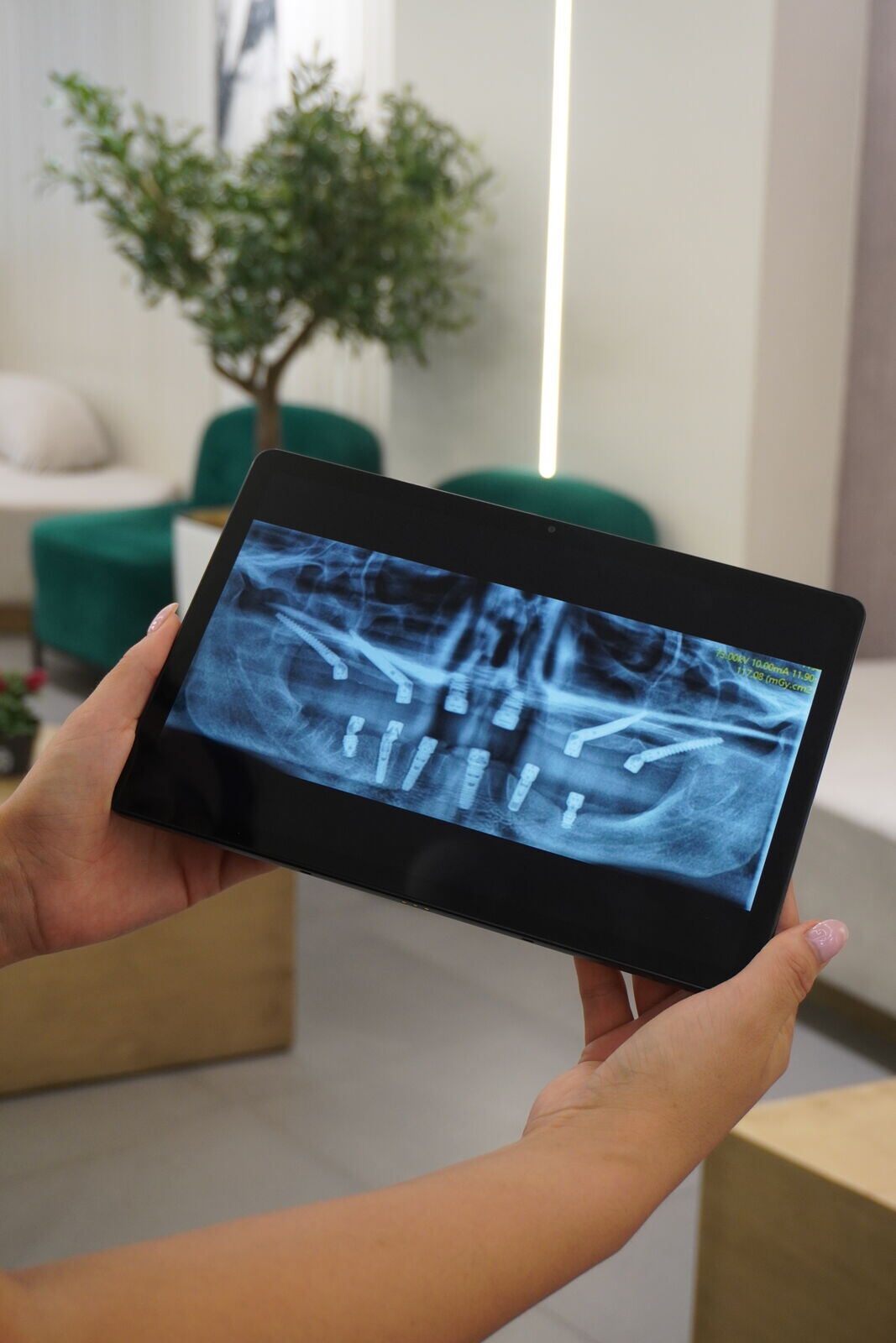 Dental team member holding a tablet displaying a full digital panoramic X-ray with visible implants, in a clinic lounge
